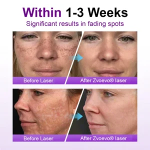 Alisanda® SpotErase Probiotic Shield Serum 11 Alisanda® SpotErase Probiotic Shield Serum