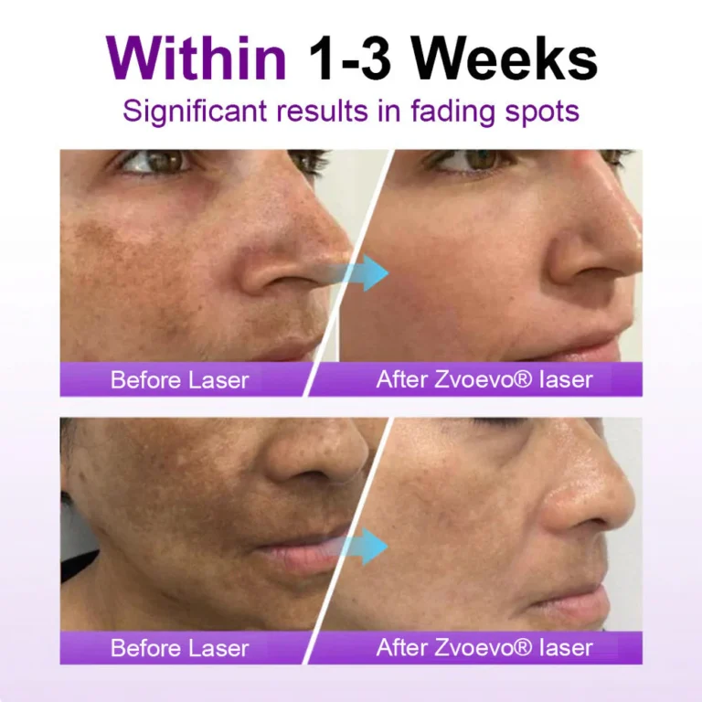 Alisanda® SpotErase Probiotic Shield Serum 4 Alisanda® SpotErase Probiotic Shield Serum