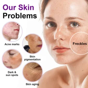 Alisanda® SpotErase Probiotic Shield Serum 9 Alisanda® SpotErase Probiotic Shield Serum