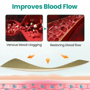 Alisanda® Varicose Veins Patch 9 Alisanda® Varicose Veins Patch