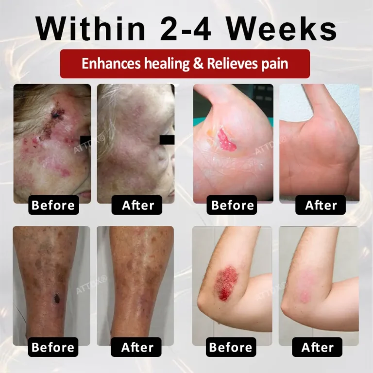 ALISANDA® GlucoseGuard Skin Rescue Cream 5 ALISANDA® GlucoseGuard Skin Rescue Cream