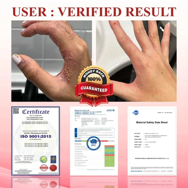 ALISANDA® GlucoseGuard Skin Rescue Cream 4 ALISANDA® GlucoseGuard Skin Rescue Cream