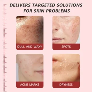 Alisanda™ Pore & Spot Care Duo| Shrinks Pores & Fades Blemish Marks 8 Alisanda™ Pore & Spot Care Duo| Shrinks Pores & Fades Blemish Marks