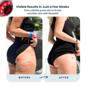 Alisanda® – Firmer, More Toned Skin 11 Alisanda® – Firmer, More Toned Skin