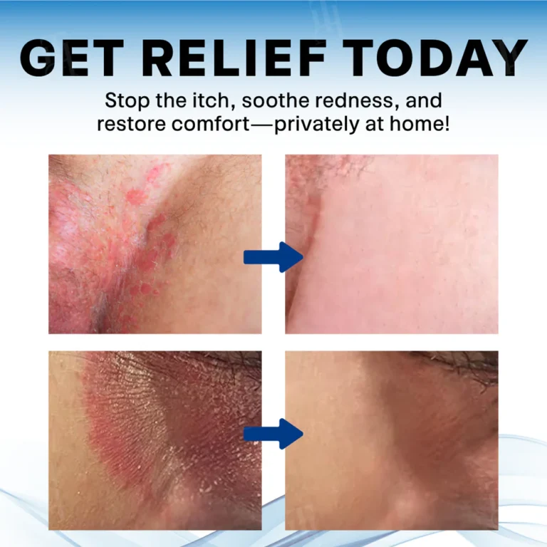 Alisanda® Scrotum Itchy Treatment Cream