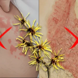 Alisanda® Jock Itch Relief Soap Bar.End the discomfort.Alisanda® Jock Itch Relief Soap Bar.End the discomfort.