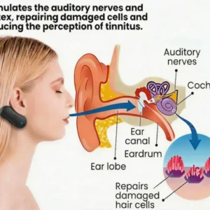 Alisanda® Tinnitus Relieving Device