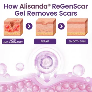 Alisanda® ReGenScar Rapid Recovery Scar Gel