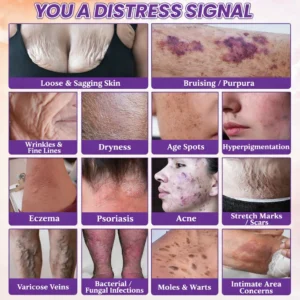 Alisanda® Biotin 10-in-1 Skin Restoration Cream