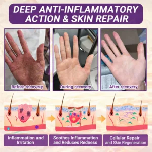 Alisanda® Biotin 10-in-1 Skin Restoration Cream