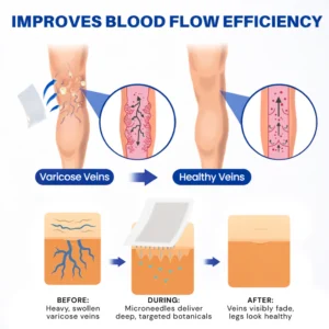 Alisanda® Vein Contour Microneedle Patch